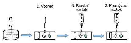 Postup testování test mužské plodnosti ADIEL